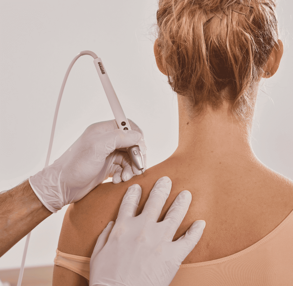 a patient undergoing electrolysis therapy in the shoulder region